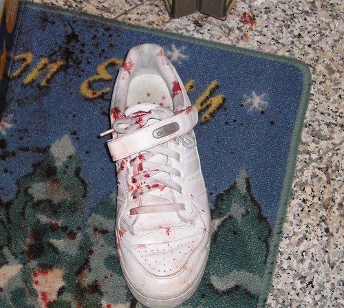 Blood splattered all over Dan Moga's white sneaker