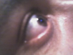 eyeball2